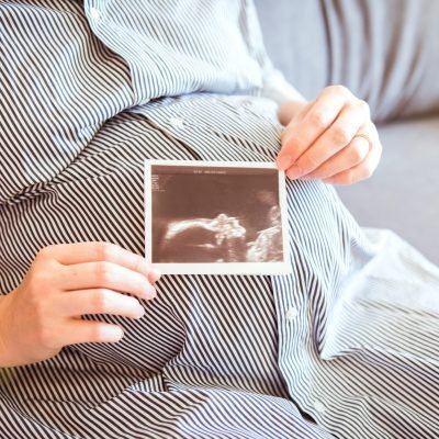 Close up of a pregnant belly with ultrasound photo